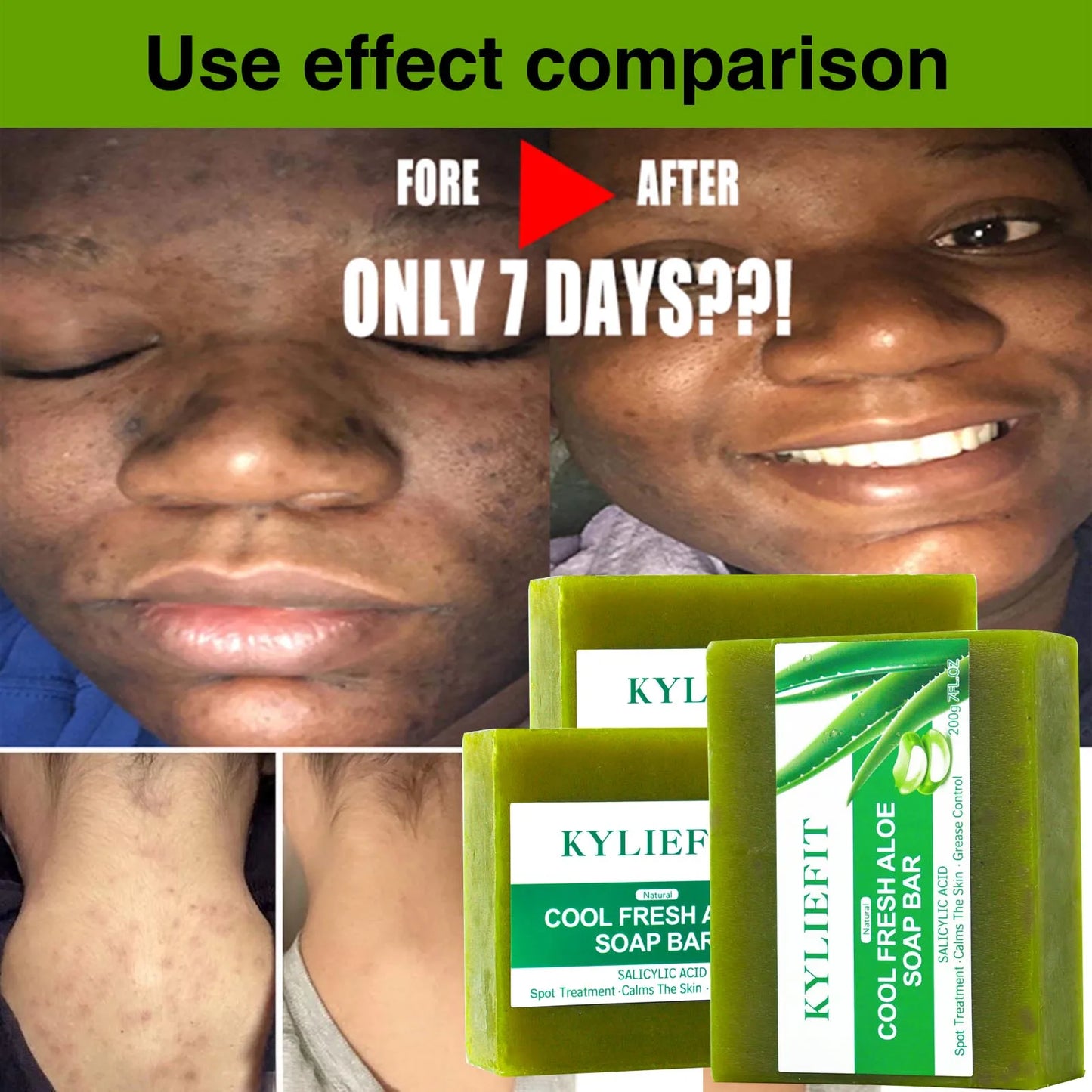 AILKE Aloe Brightening Soap Bar For Face And Body Daily Use