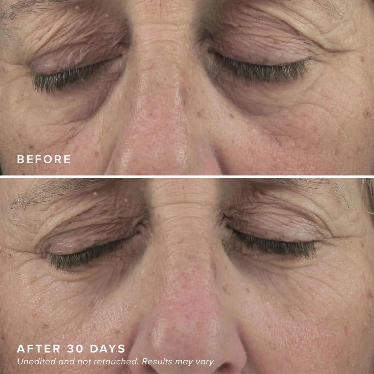 Brightening Eye Masks With Hyaluronic Acid And Caffeine Patches