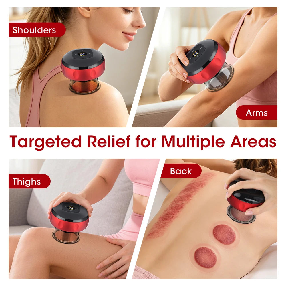 PastSky Rechargeable Smart Cupping Device With Electric Heating